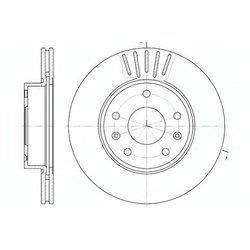 Remsa 6670.10